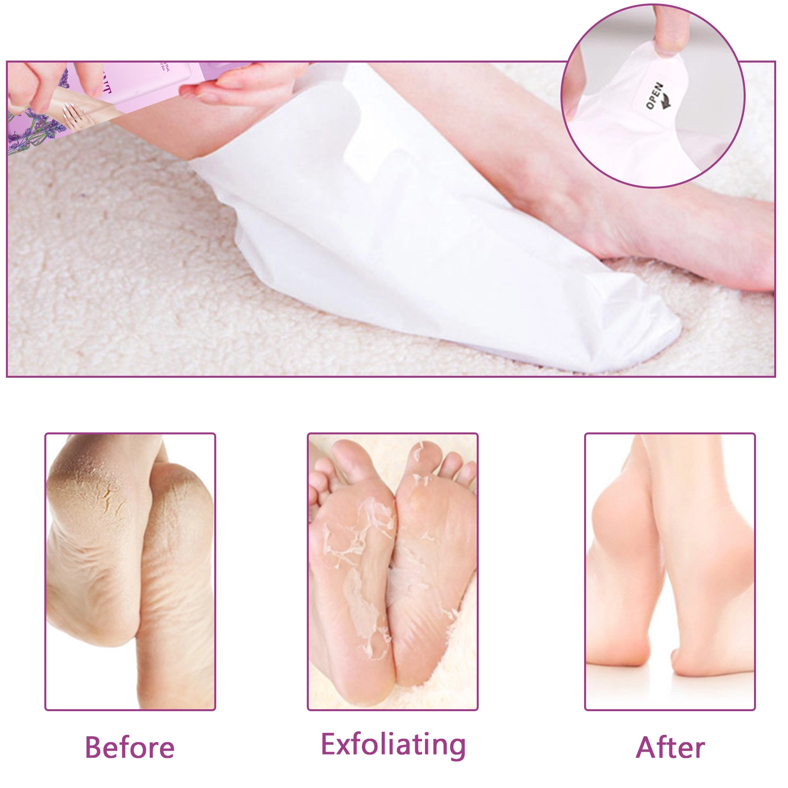 ALIVER 3in1 Exfoliating Foot Care Treatment Kit Peeling Mask