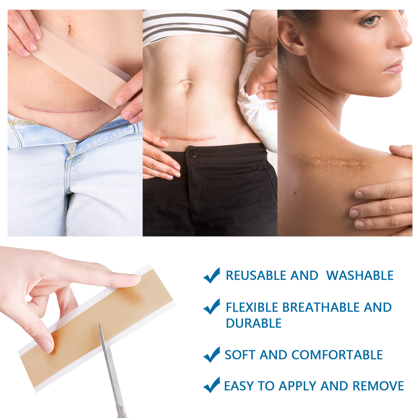 VALLEYLUX Silicone Scar Tape, 1.5m