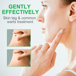 ALIVER Body Skin Tag & Wart Remover Ointment, 20g