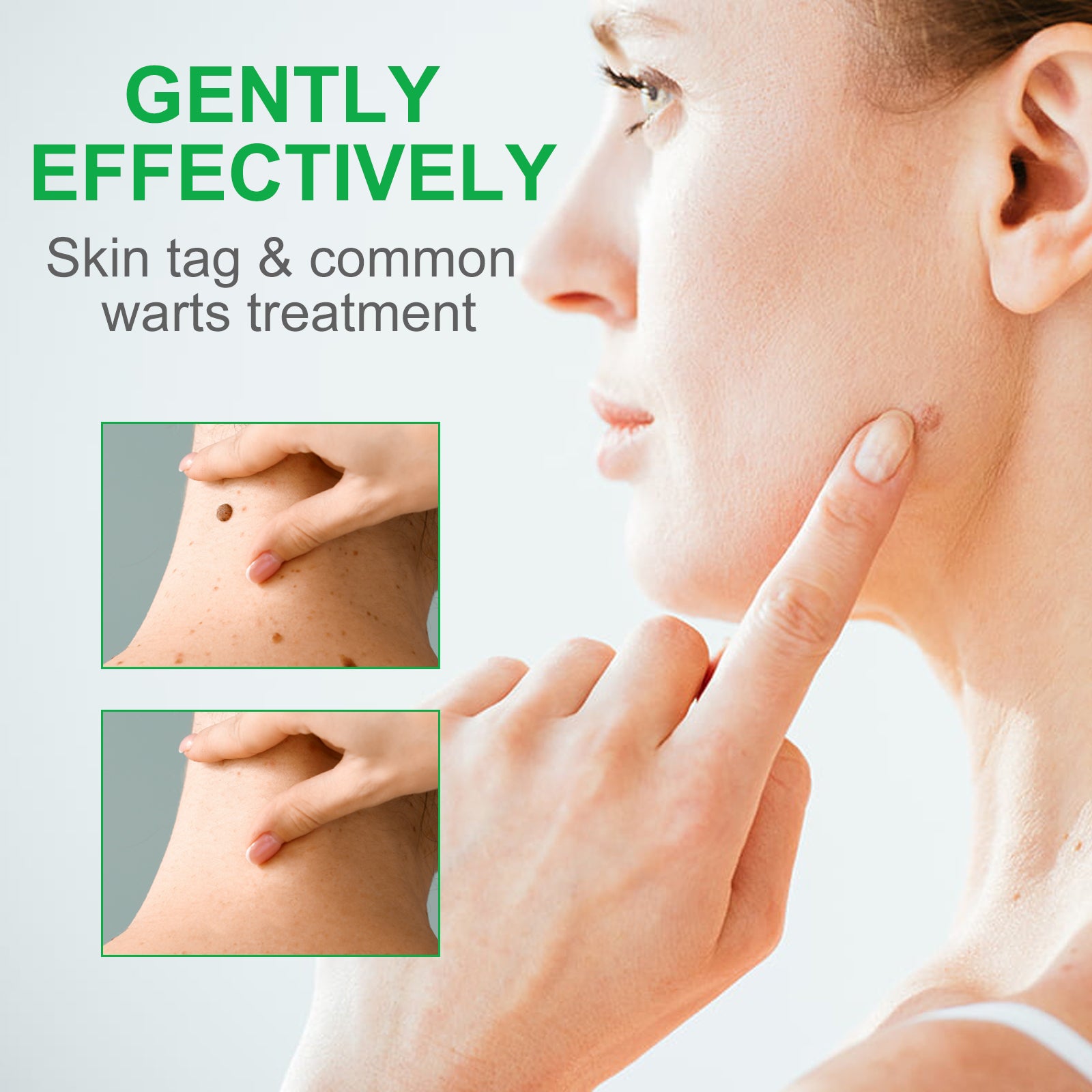 ALIVER Body Skin Tag & Wart Remover Ointment, 20g