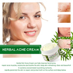 ELAIMEI Herbal Acne Treatment Cream, 50g