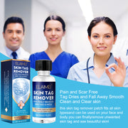 ELAIMEI Skin Tag Remover, Wart & Mole Body Liquid, 30ml