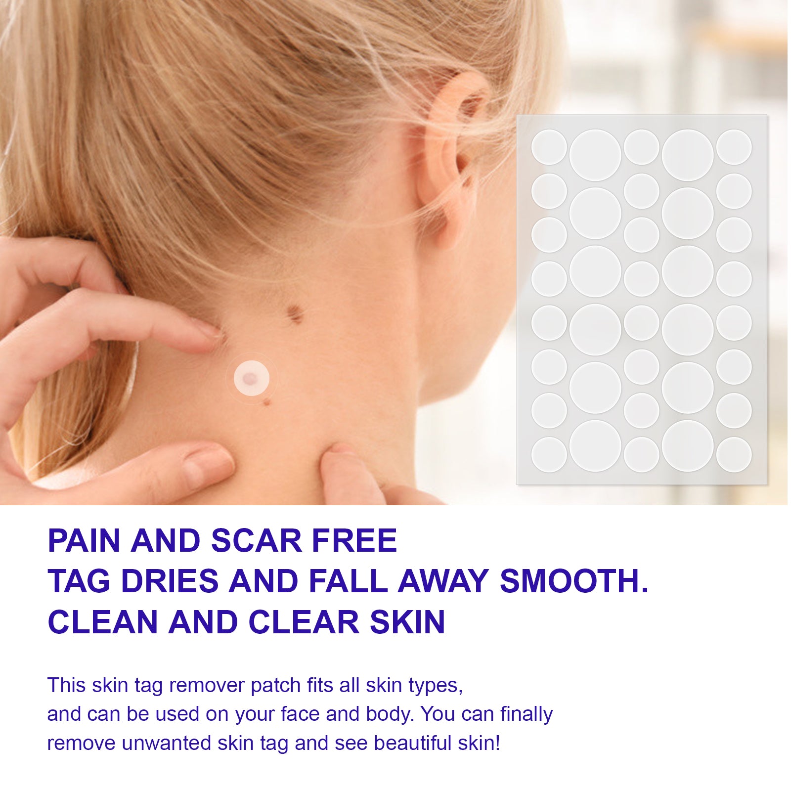 ALIVER Safe Skin Tag Remover Patches, pack of 180pcs