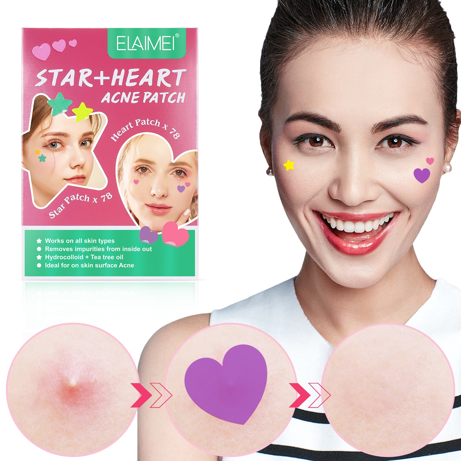 ELAIMEI Stars + Heart Pimple Patches, pack of 156pcs