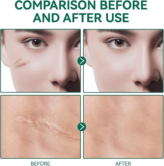 ENVISHA Scar Removal Gel, 50ml