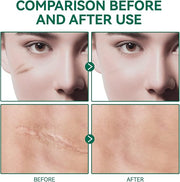 ENVISHA Scar Removal Gel, 50ml