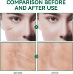 ENVISHA Scar Removal Gel, 50ml