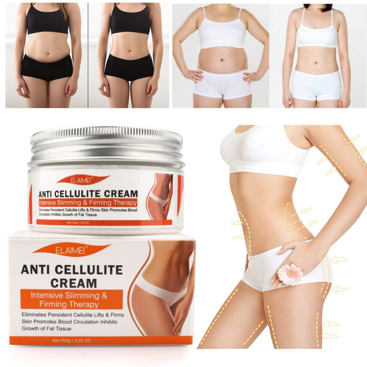 ELAIMEI Anti Cellulite Body Cream, 100g