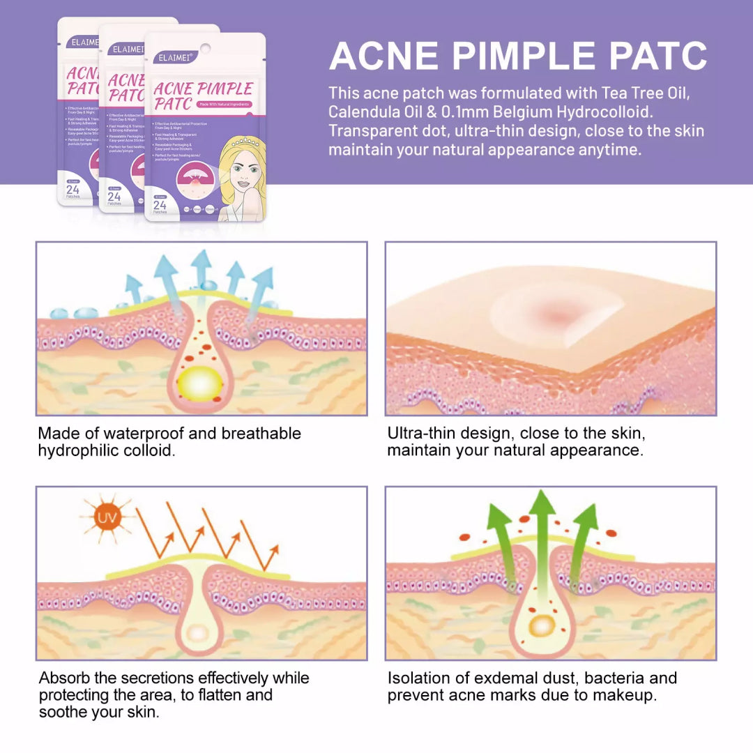 Elaimei Removal Acne Pimple Patches Plasters Face Skin Dot Stickers Cover Treatment Hydrocolloid Spot Blemishes Comedone Remover Cleaner (24 pcs )