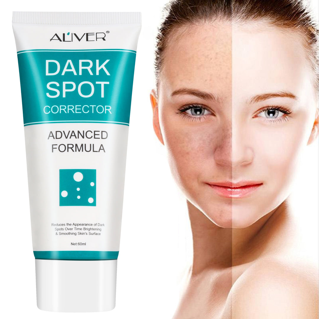Aliver Dark Spot Remover Corrector Brighter for Face Body Skin Cream