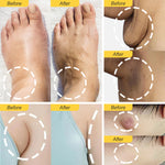 ELAIMEI Lymphatic Drainage Herbal Shower Gel, 30ml X 3 (Ginger)