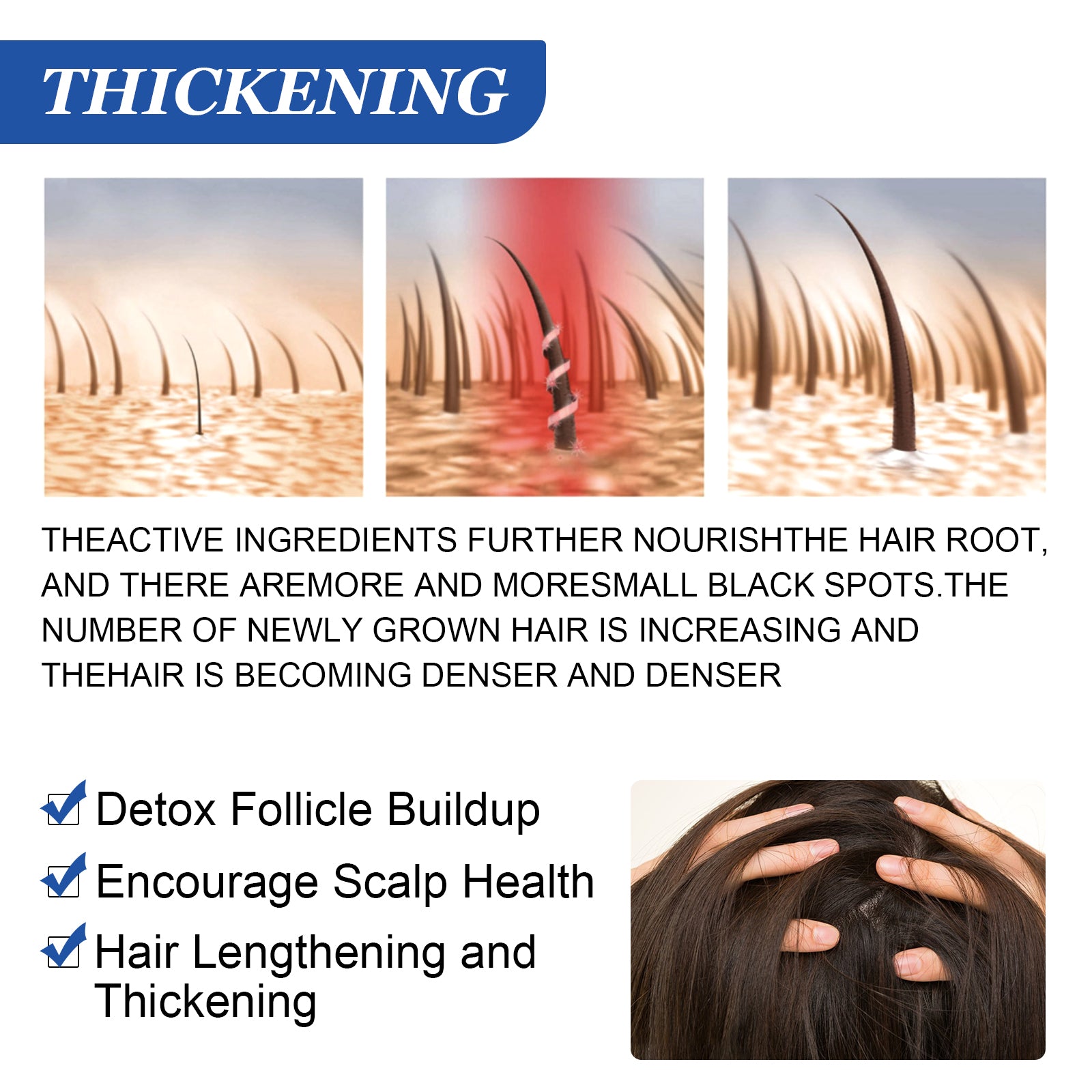 PEGCIZ Scalp Serum for Hair Growth, 30ml