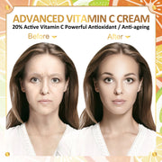 Ifudoit Facial Vitamin C Cream Face Anti-Aging Moisturizer Retinol Wrinkle Skin Care Hydrating Repair Reduce Fine Line Hyaluronic Acid