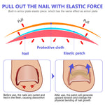 SEFUDUN Toenail Correction Stickers, pack of 100pcs