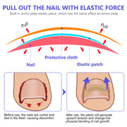 SEFUDUN Toenail Correction Stickers, pack of 100pcs