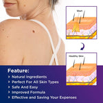 ELAIMEI 2n1 Skin Tag Remover Pens & Anti Acne Patches Set