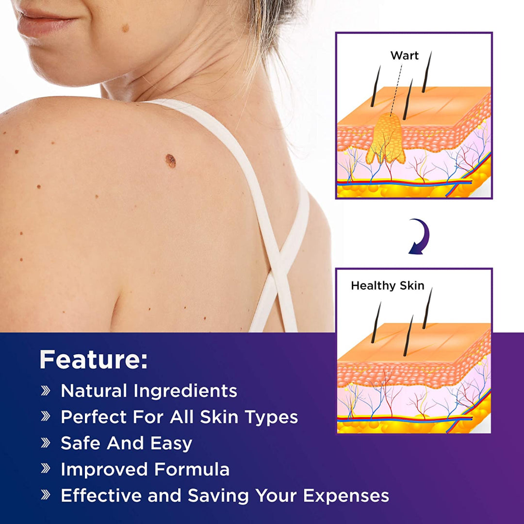 ELAIMEI 2n1 Skin Tag Remover Pens & Anti Acne Patches Set