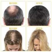 SEFUDUN Hair Growth Serum + Derma Roller Kit