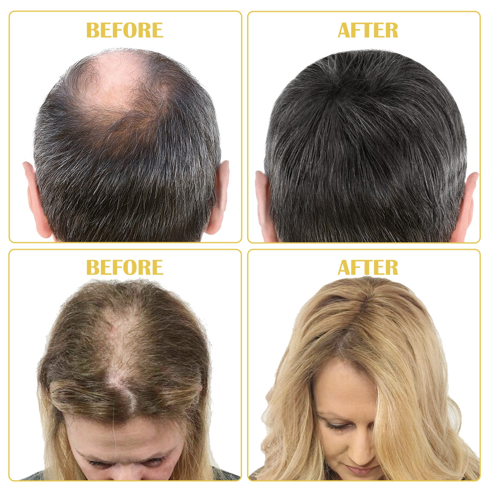 SEFUDUN Hair Growth Serum + Derma Roller Kit