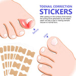 SEFUDUN Toenail Correction Stickers, pack of 100pcs