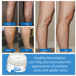 VOGSIG Varicose Veins Cream, 50g