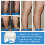 VOGSIG Varicose Veins Cream, 50g