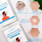 ELAIMEI Patches for Skin Tag & Acne Removal, 144pcs