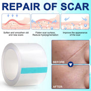 ALIVER Silicone Scar Removal Sheet, 1.5m