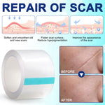ALIVER Silicone Scar Removal Sheet, 1.5m