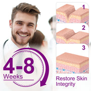 Elaimei Silicone Scar Removal Gel Tape Roll for Skin Treatment Repair 1.5 m