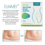 Elaimei Silicone Gel Sheet Roll for Scar Removal Treatment Tape 1.5M