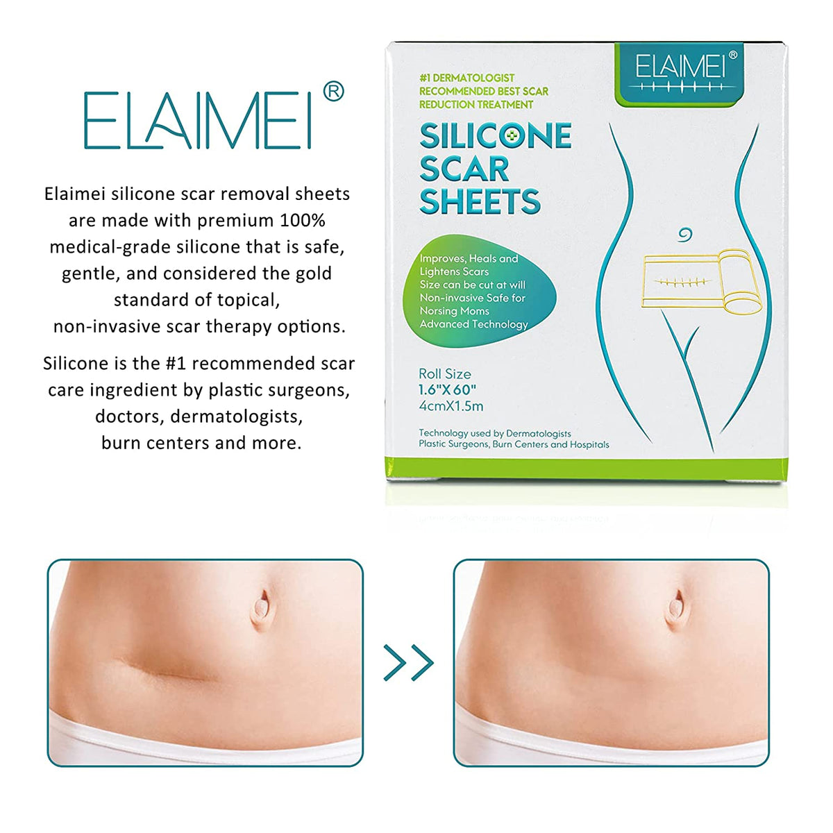 Elaimei Silicone Gel Sheet Roll for Scar Removal Treatment Tape 1.5M