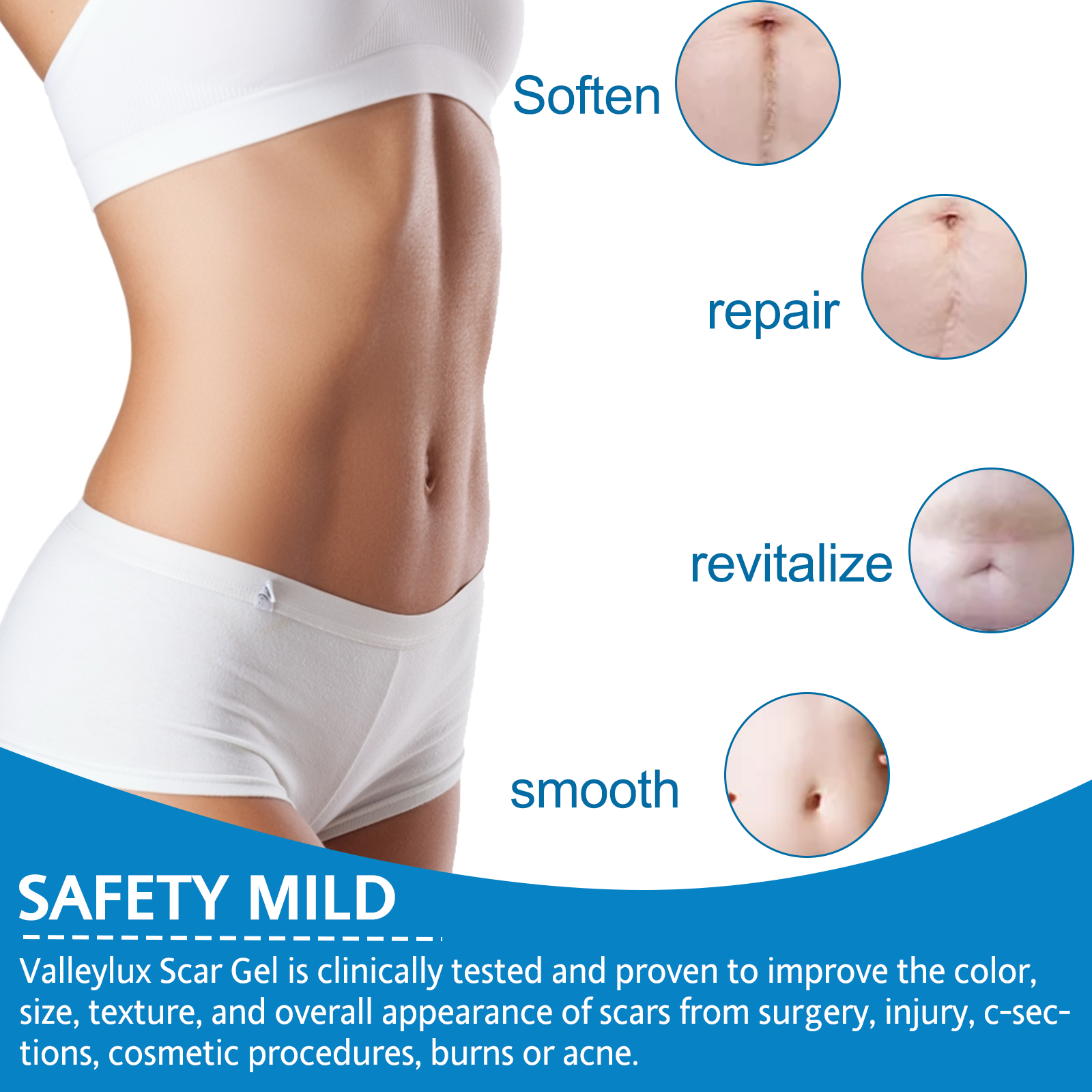 VALLEYLUX Silicone Scar Tape, 1.5m