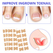 SEFUDUN Toenail Correction Stickers, pack of 100pcs