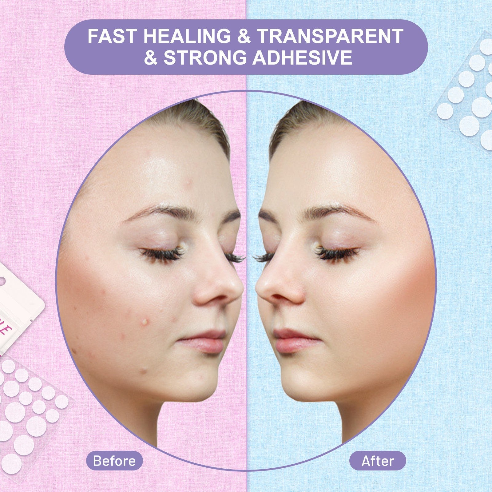 Elaimei Removal Acne Pimple Patches Plasters Face Skin Dot Stickers Cover Treatment Hydrocolloid Spot Blemishes Comedone Remover Cleaner (24 pcs )