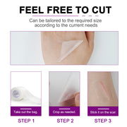 Elaimei Silicone Scar Removal Gel Tape Roll for Skin Treatment Repair 1.5 m