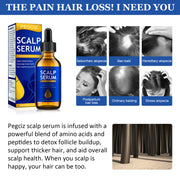 PEGCIZ Scalp Serum for Hair Growth, 30ml