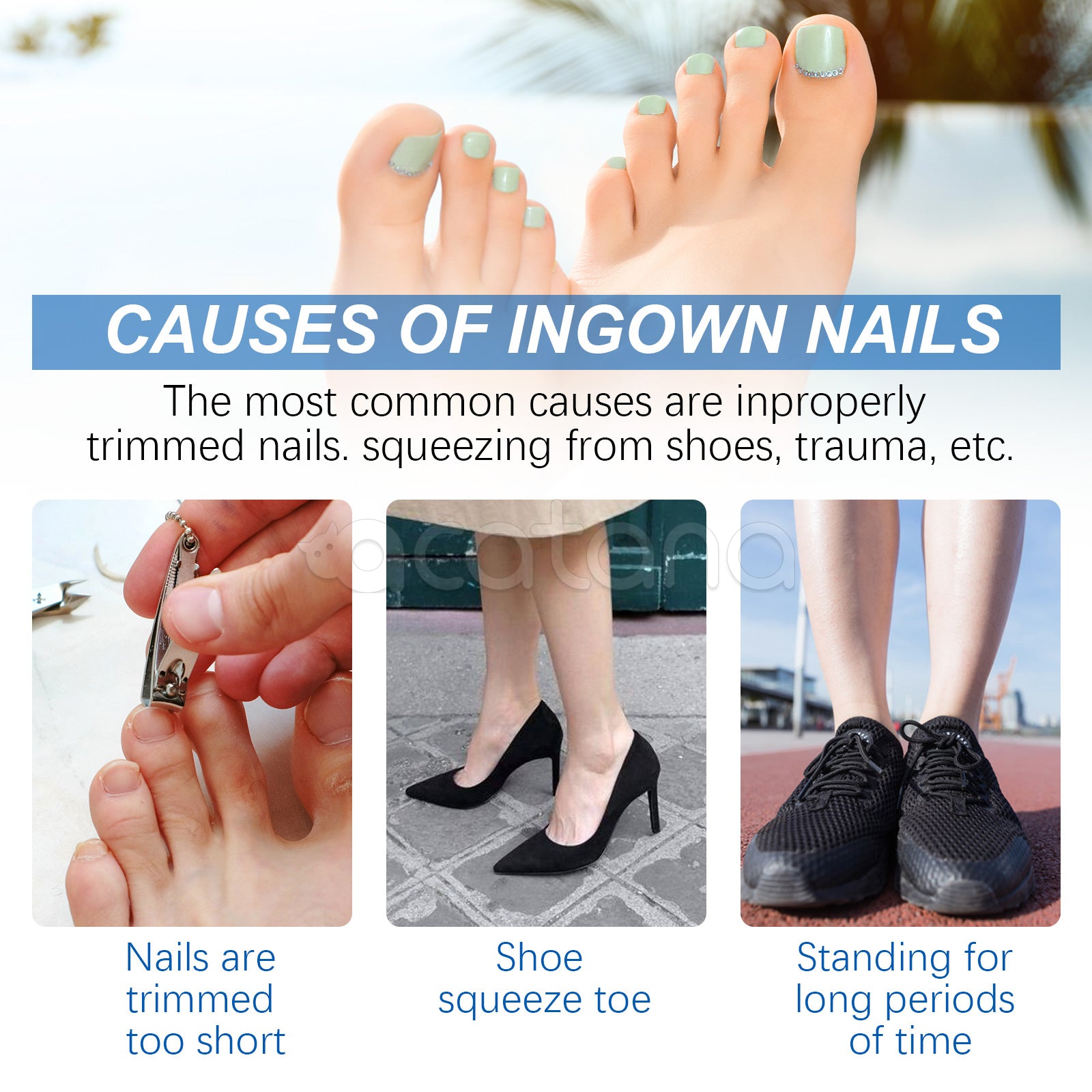 SEFUDUN Removal Paronychia Oil, 30ml