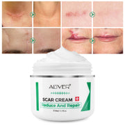 Aliver Treatment Scar Remove Cream for Body Face Skin