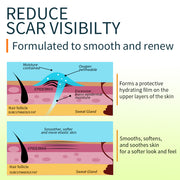 ENVISHA Scar Removal Gel, 50ml