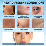 ELAIMEI Ice Roller Facial Cube Massager, Blue