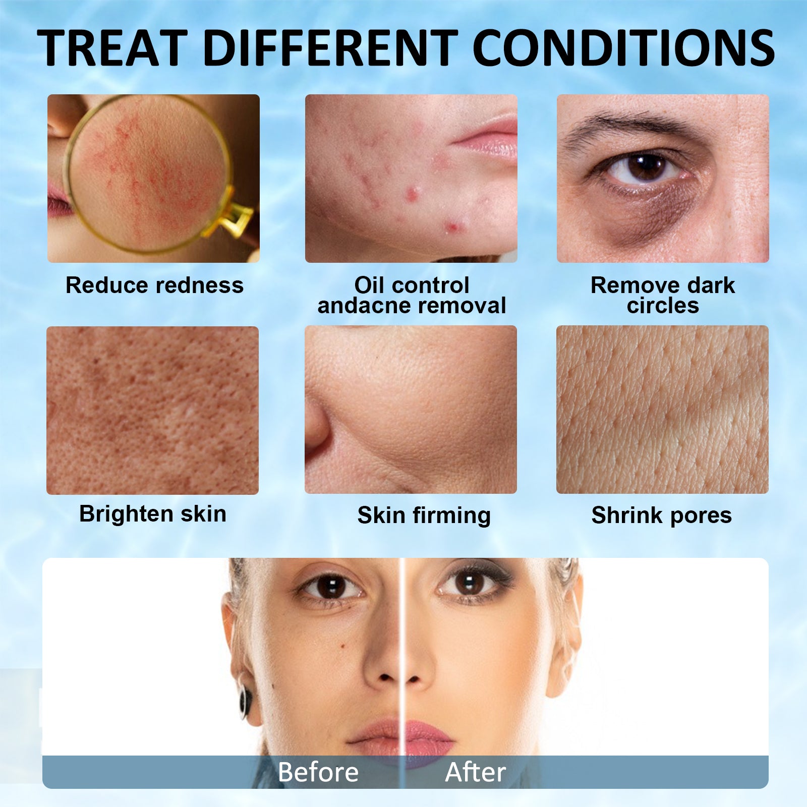 ELAIMEI Ice Roller Facial Cube Massager, Blue