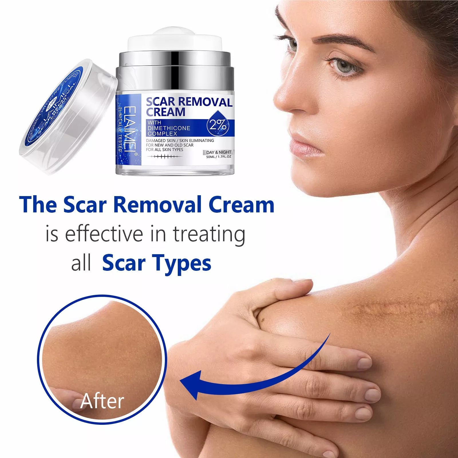 ELAIMEI Advanced Scar Removal Cream, Day & Night 50ml