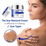 ELAIMEI Advanced Scar Removal Cream, Day & Night 50ml