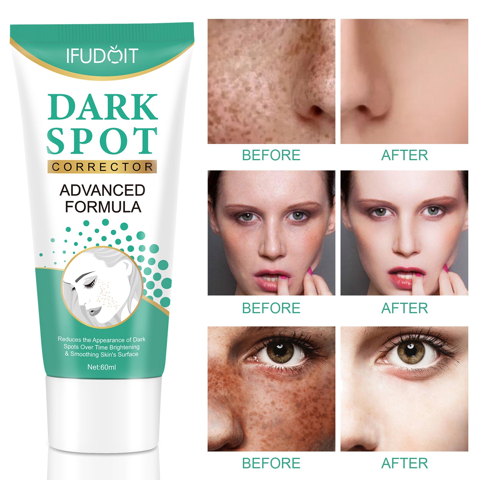 Iffudoit Dark Spot Skin Correcting Cream Remover for Face and Body