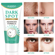Iffudoit Dark Spot Skin Correcting Cream Remover for Face and Body