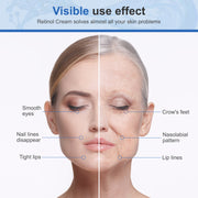 ELAIMEI 2,5% Pure Retinol Cream for Face