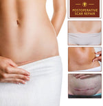 ALIVER Removal Gel Ointment for Scar & Acne Marks, 30ml