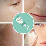 Iffudoit Dark Spot Skin Correcting Cream Remover for Face and Body