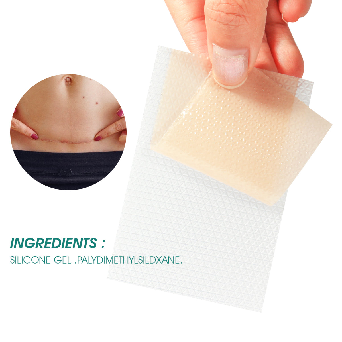 Elaimei Silicone Sheets for Scar Removal